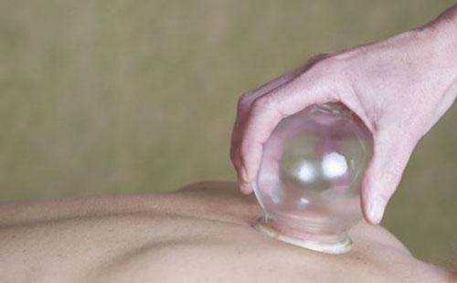 拔火罐要注意什么（女生拔火罐要注意什么）