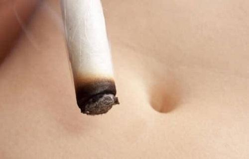 艾灸对水肿有效果吗 艾灸为什么能治疗水肿-九图集