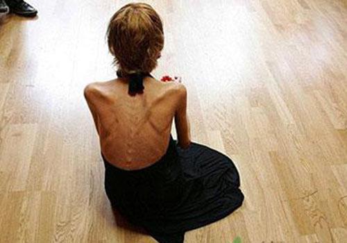 厌食症是什么病 厌食症是啥