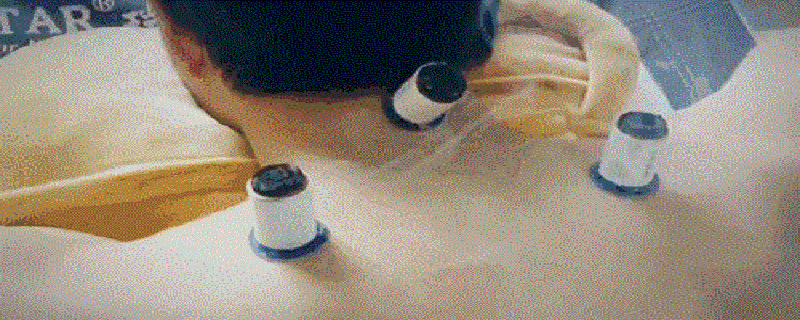 呃逆艾灸治疗方法(呃逆灸哪里)-九图集