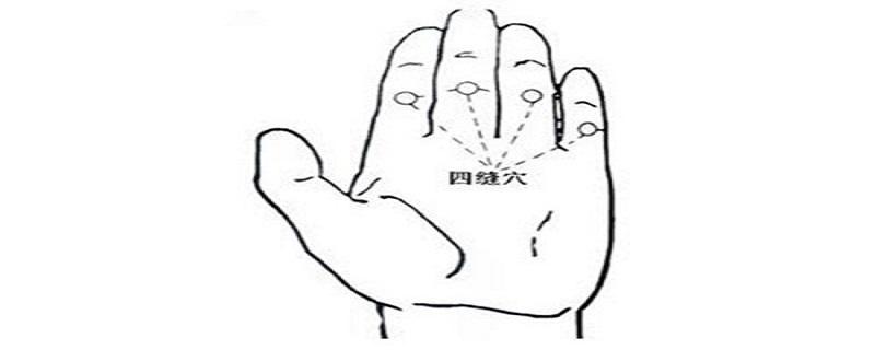 四缝放血的作用 大人扎四缝放血的作用