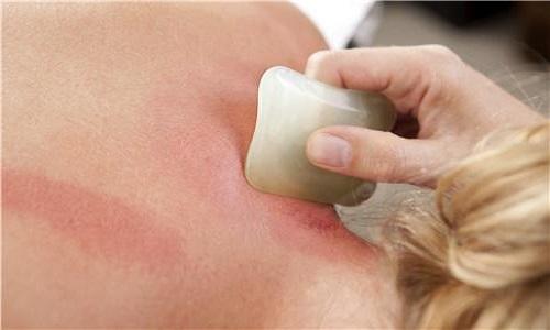 牙疼刮痧刮哪里图解 牙疼刮痧刮哪里位置图-九图集