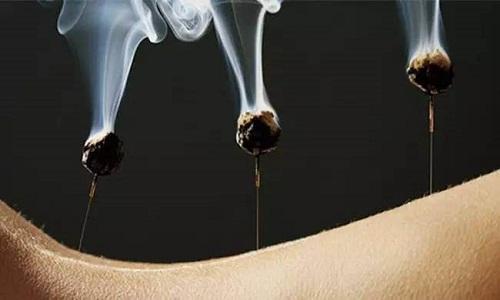 艾灸对高血压有好处吗(艾灸对高血压有好处吗知乎)