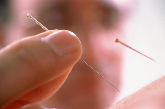 中医扫盲:全面了解针灸减肥的九大盲点-九图集