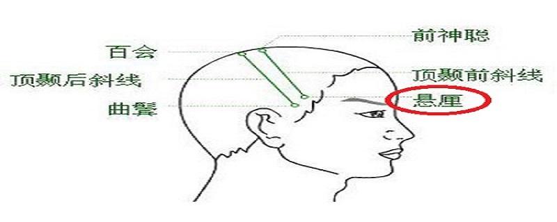 悬厘准确位置图 悬厘的准确位置图片-九图集