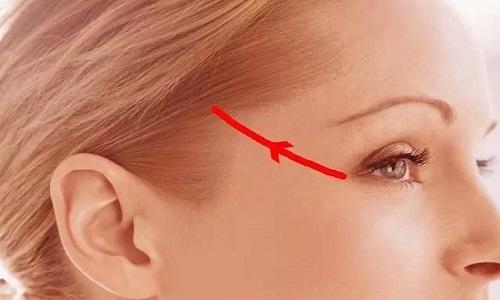 眼睑浮肿按摩哪个位置 眼睑浮肿按摩哪个位置好-九图集
