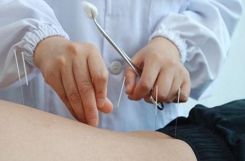 针灸对腰痛有效果吗（针灸对腰疼只是缓解作用吗）-九图集