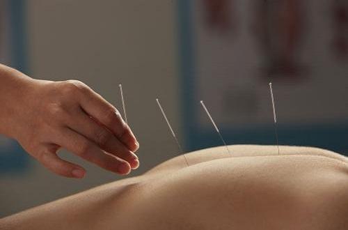 针灸对腰间盘突出效果明显吗（针灸对腰间盘突出效果好吗）-九图集