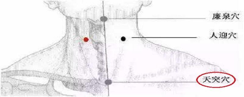 天突的针刺方法(天突的针刺方向)