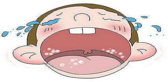 鹅口疮推拿手法 鹅口疮推拿手法有几种-九图集