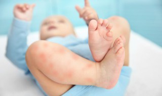 一到冬天晚上身上就痒怎么回事（冬天每到晚上身上就痒）