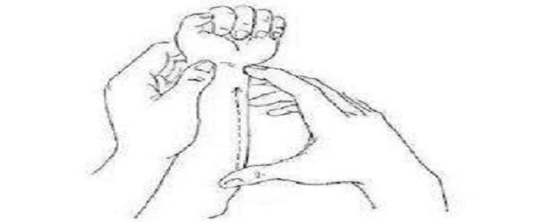 小儿鹅口疮按摩哪里(鹅口疮可以推拿吗)