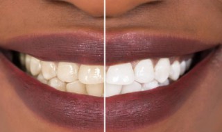 盐水漱口的好处和坏处 盐水漱口有什么好处和坏处