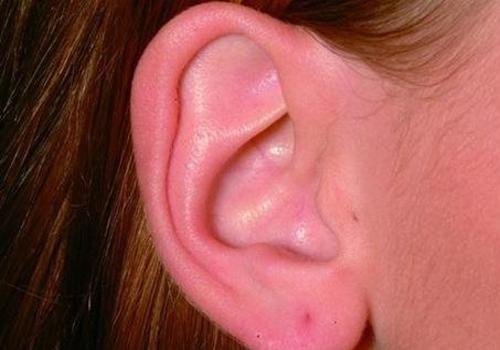 游泳后耳朵进水耳内响怎么办 游泳耳朵进水有水声