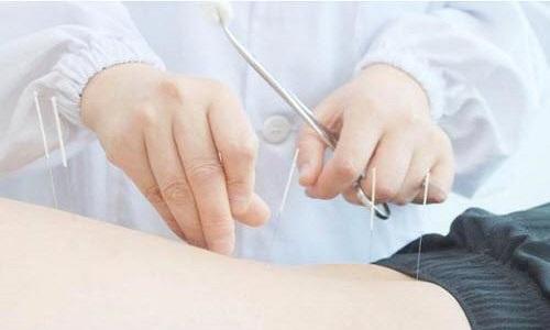 腰间盘突出针灸管用吗 腰间盘突出用针灸有用吗