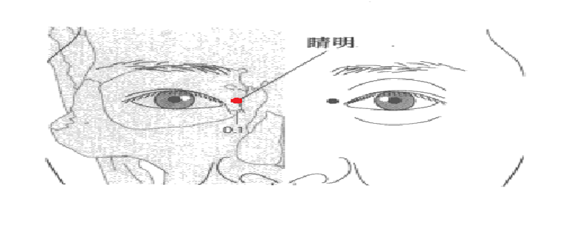 睛明的准确位置图视频 晴明的准确位置图片图-九图集