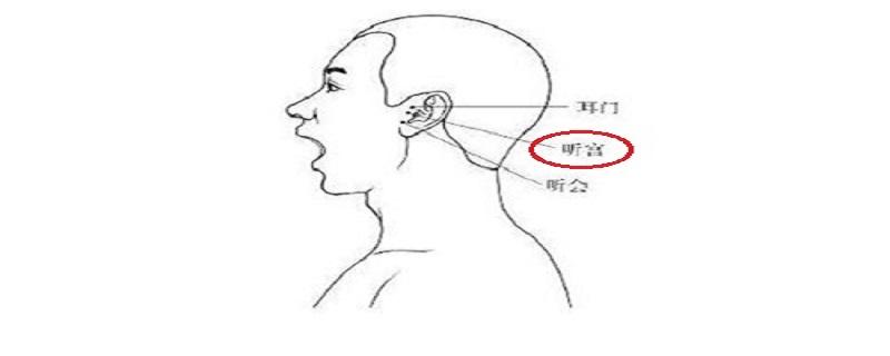 针刺听宫操作要点 听宫的针刺方法-九图集