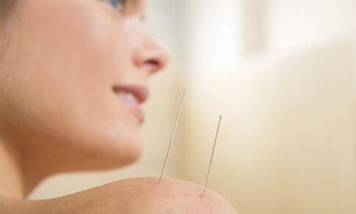 针灸对肩周炎有效果吗 肩周炎针灸有副作用吗-九图集