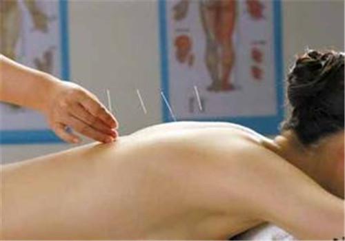 带状疱疹可以针灸吗(带状疱疹可以针灸吗?)-九图集