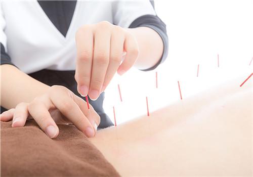 针灸可以去湿气吗（针灸可以去湿气和寒气吗）-九图集