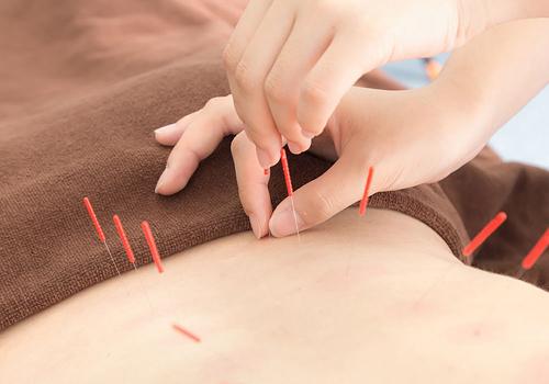 冬天可以做针灸吗（冬天不适合针灸吗）-九图集