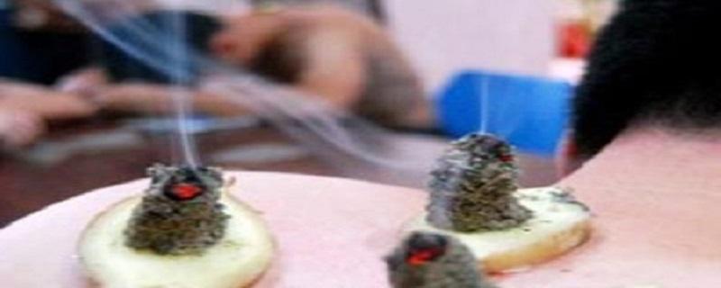 艾灸前列腺炎位置图片 艾灸前列腺炎位置图片大全