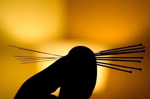 针灸多长时间一次最好 针灸一次最长多少时间-九图集