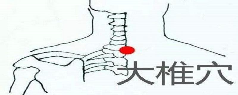 针刺大椎有什么作用(刺血大椎的作用)