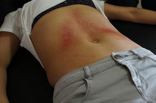 刮痧对肠胃有作用吗 刮痧对肠胃有帮助吗-九图集