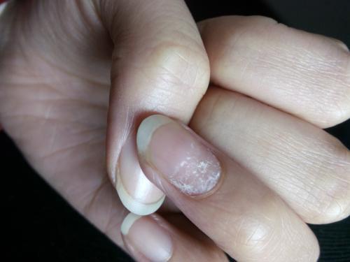 肝不好有什么症状(肝不好有什么症状有哪些表现女)