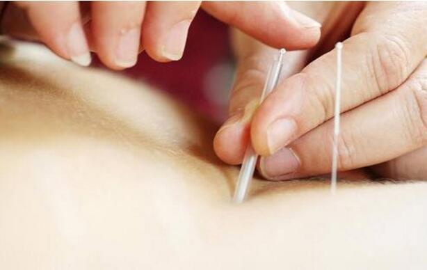 晕针的原因及处理（晕针主要原因）-九图集