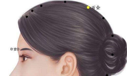 失眠针灸哪里最好 失眠针灸怎么样-九图集