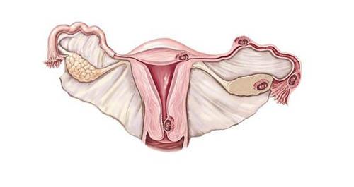 子宫腺肌症的症状表现(轻度子宫腺肌症的症状表现)