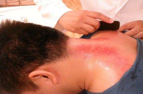 刮痧对失眠有帮助吗（刮痧后失眠属于正常吗?）-九图集