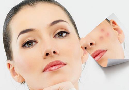 孕妇长痘痘是什么原因(孕妇长痘痘是什么原因引起的)-九图集